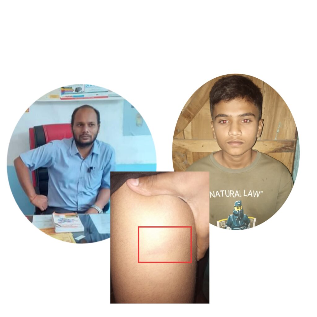 क्लास वर्क नगरेको भन्दै सगरमाथा स्कुलमा शिक्षकद्धारा विद्यार्थी लाई कुटपिट