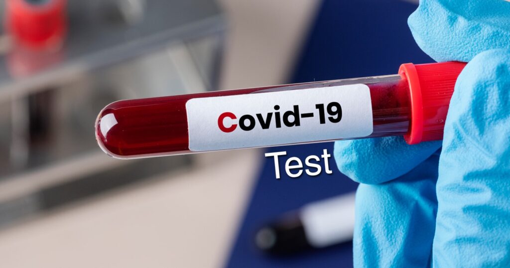 कोरोनाको थप नयाँ भेरियन्ट पत्ता लाग्यो नेपालमा