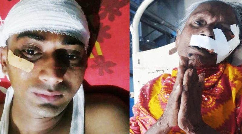 वीरगञ्जमा प्रहरी र माछा व्यापारी बीच झडप: ३ प्रहरीसहित ५ जना घाइते